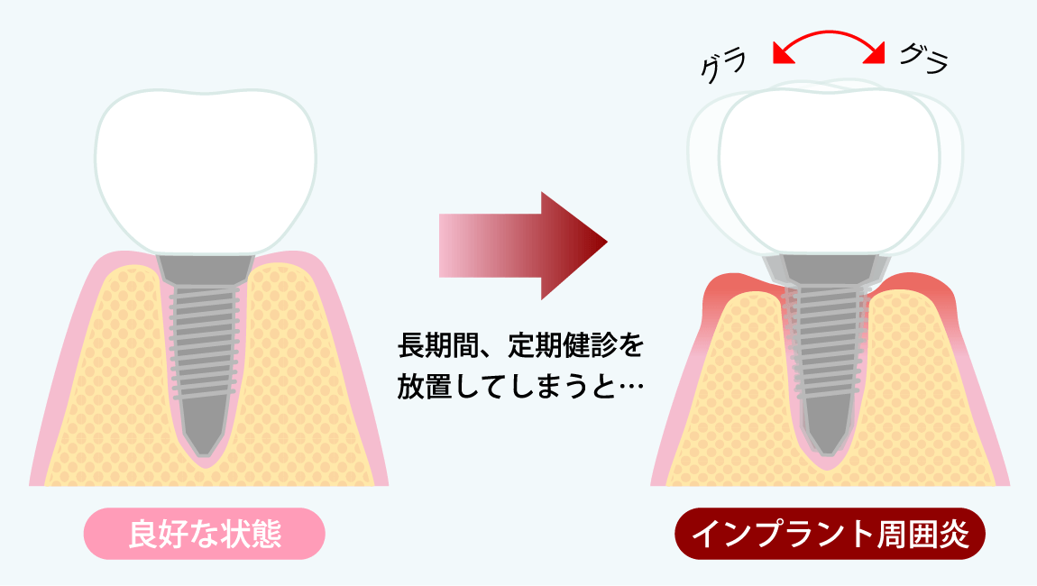 長期間、定期健診を放置してしまうと・・・